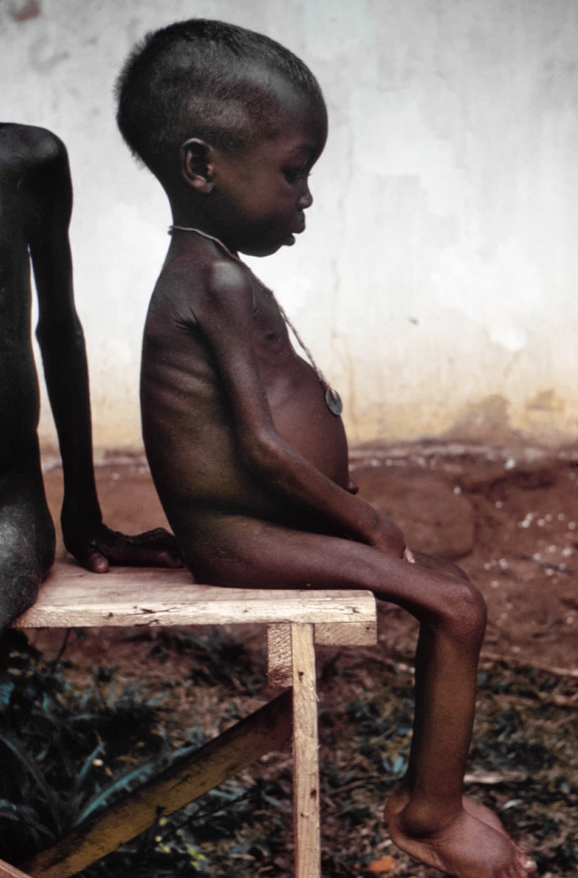 266 Million on the Brink: The Global Hunger Crisis of 2026